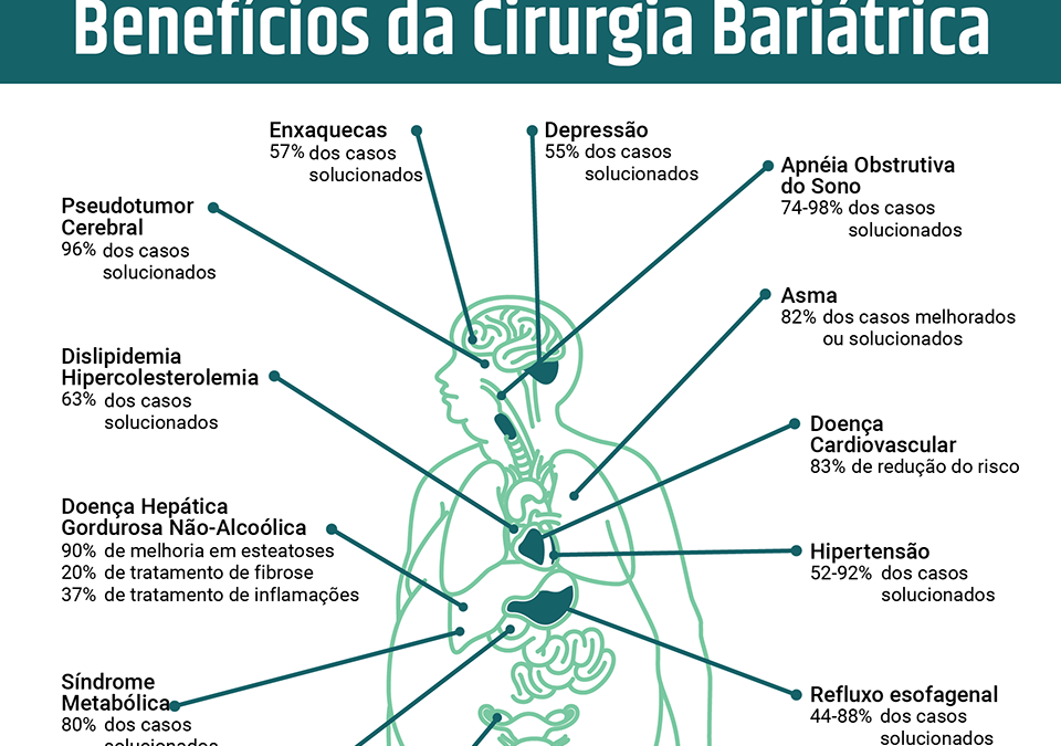 Benefícios da Cirurgia Bariátrica - IGED Gastro em Joinville