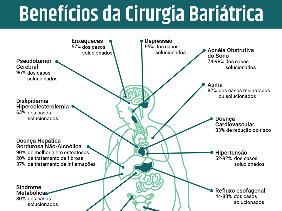 Benefícios da Cirurgia Bariátrica - IGED Gastro em Joinville